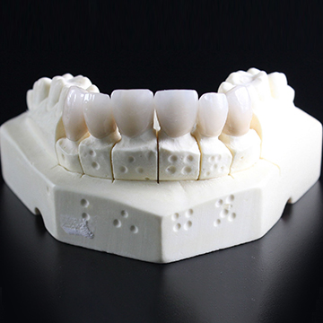 Full Mouth Reconstruction