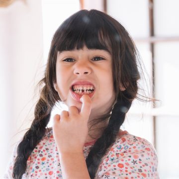 Preparing Yourself for Wisdom Tooth Surgery