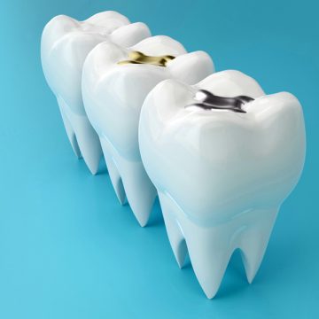 How Do You Know If You Need a Dental Filling or Something More Serious?